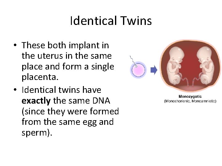 Identical Twins • These both implant in the uterus in the same place and Identical Twins • These both implant in the uterus in the same place and
