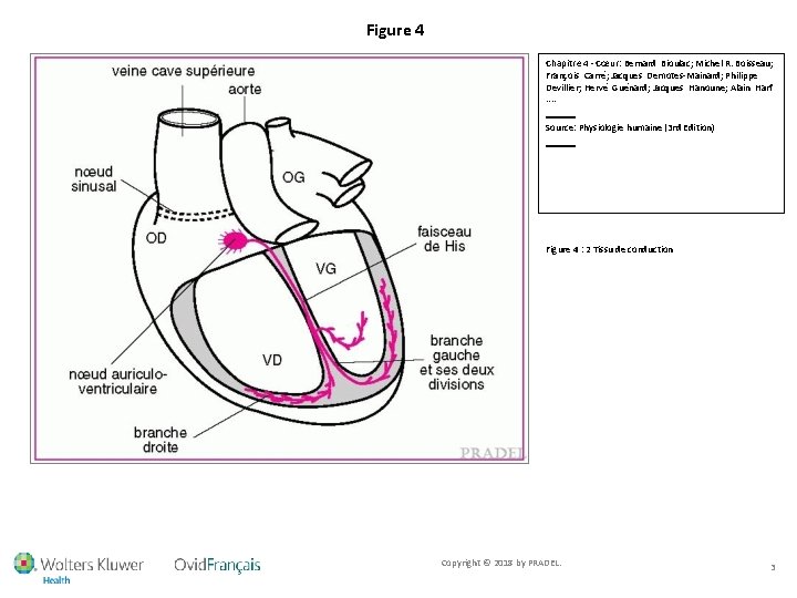 Figure 4 Chapitre 4 - Cœur: Bernard Bioulac; Michel R. Boisseau; François Carré; Jacques