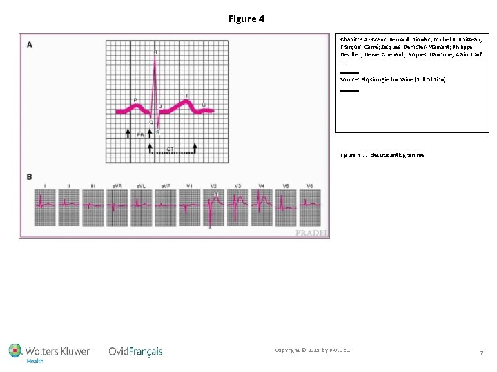 Figure 4 Chapitre 4 - Cœur: Bernard Bioulac; Michel R. Boisseau; François Carré; Jacques