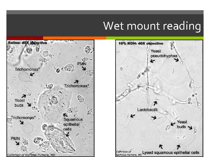 Wet mount reading 