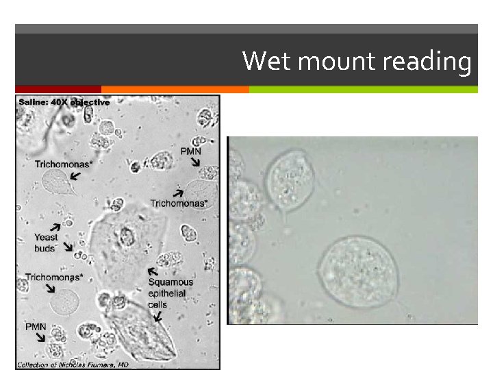 Wet mount reading 