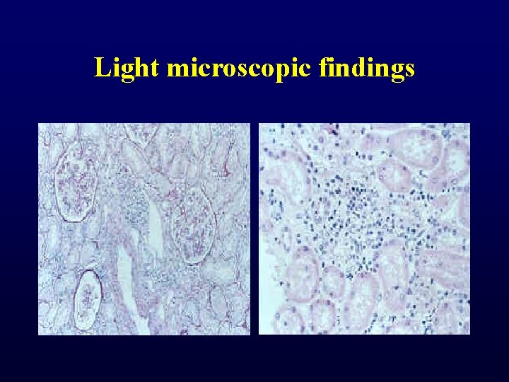 Light microscopic findings Light microscopic findings