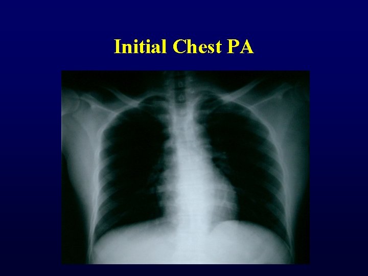 Initial Chest PA Initial Chest PA