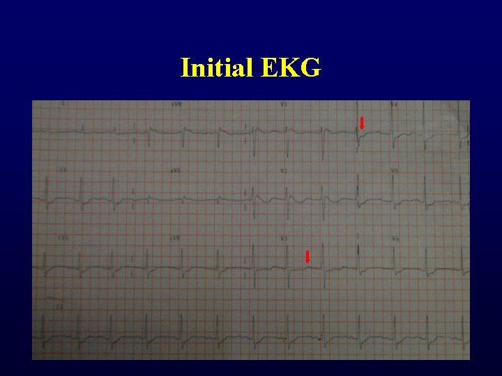 Initial EKG Initial EKG