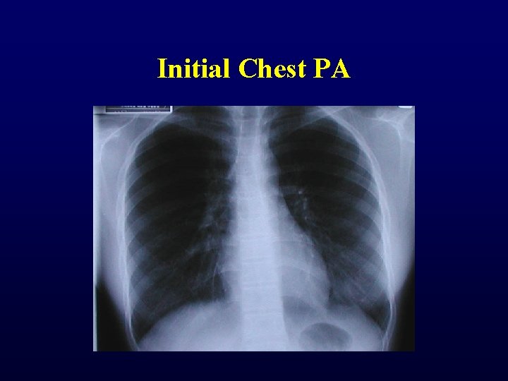 Initial Chest PA Initial Chest PA