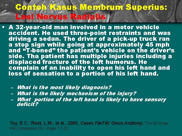 Contoh Kasus Membrum Superius: Lesi Nervus Radialis • A 32 -year-old man involved in