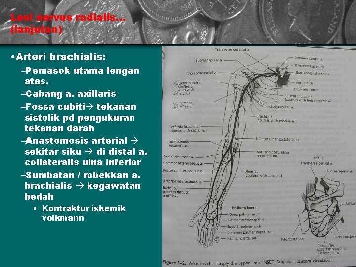 Lesi nervus radialis. . . (lanjutan) • Arteri brachialis: –Pemasok utama lengan atas. –Cabang