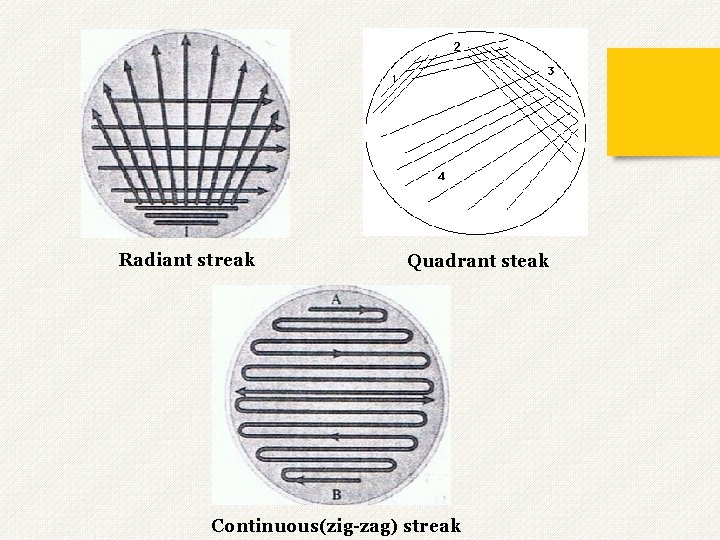 Radiant streak Quadrant steak Continuous(zig-zag) streak 