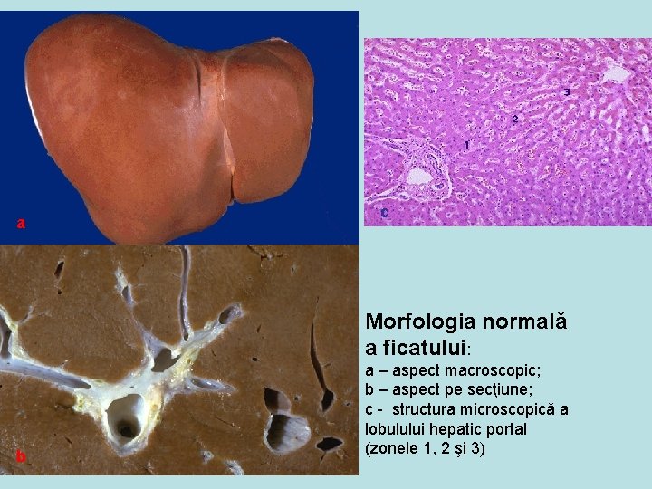 a c Morfologia normală a ficatului: b a – aspect macroscopic; b – aspect