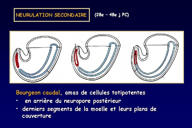 NEURULATION SECONDAIRE (28 e – 48 e j PC) Bourgeon caudal, amas de cellules NEURULATION SECONDAIRE (28 e – 48 e j PC) Bourgeon caudal, amas de cellules