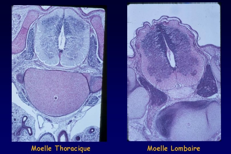 Moelle Thoracique Moelle Lombaire Moelle Thoracique Moelle Lombaire