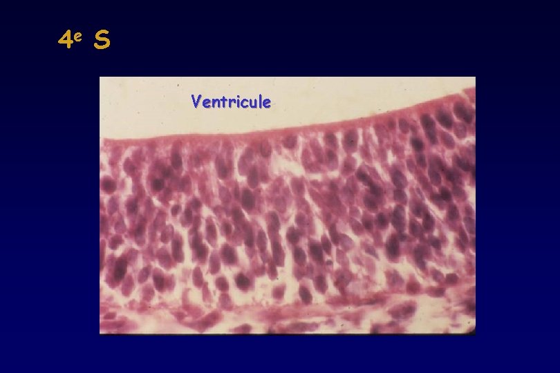 4 e S Ventricule 4 e S Ventricule