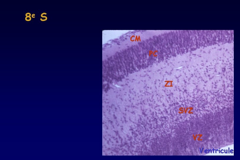 8 e S CM PC ZI SVZ VZ Ventricule 8 e S CM PC ZI SVZ VZ Ventricule