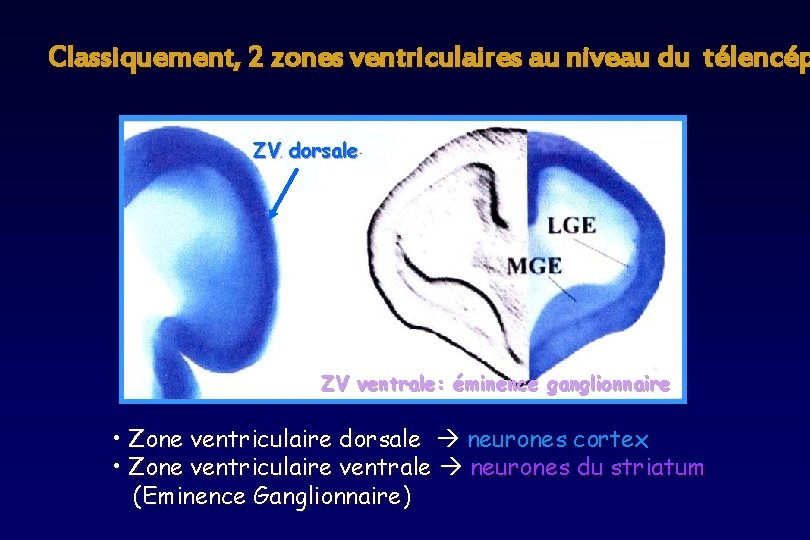 Classiquement, 2 zones ventriculaires au niveau du télencép ZV dorsale ZV ventrale: éminence ganglionnaire Classiquement, 2 zones ventriculaires au niveau du télencép ZV dorsale ZV ventrale: éminence ganglionnaire