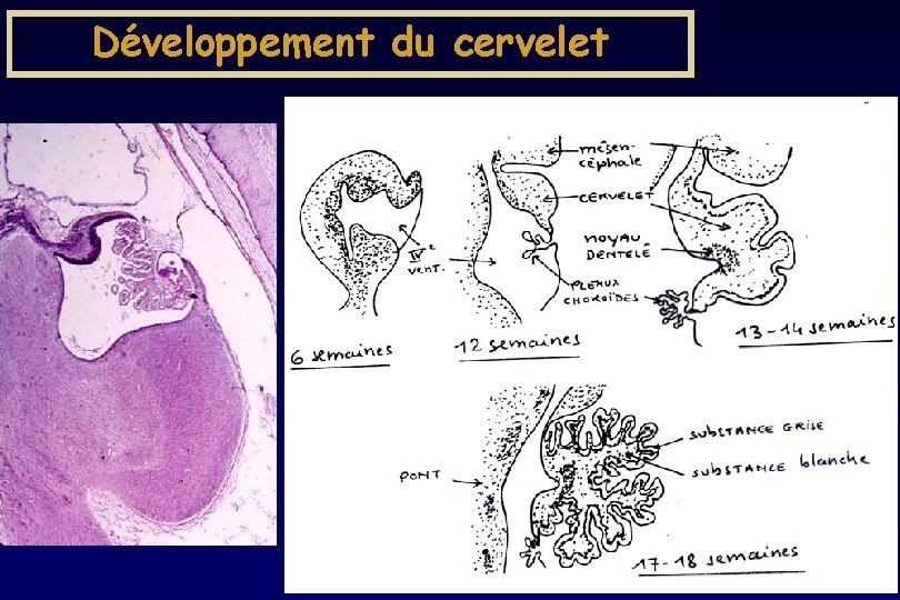 Développement du cervelet Développement du cervelet