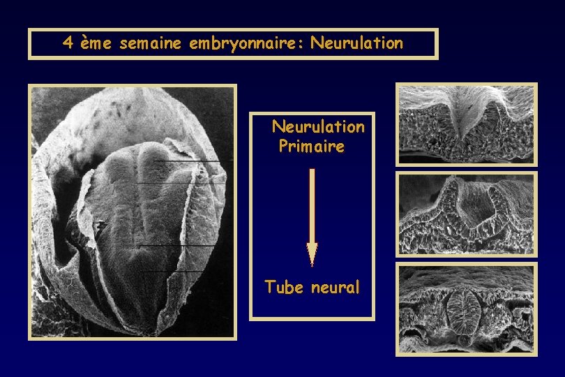 4 ème semaine embryonnaire: Neurulation Primaire Tube neural 4 ème semaine embryonnaire: Neurulation Primaire Tube neural