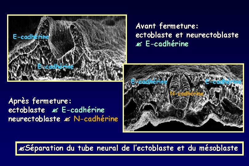 E-cadhérine Avant fermeture: ectoblaste et neurectoblaste E-cadhérine Après fermeture: ectoblaste E-cadhérine neurectoblaste N-cadhérine E-cadhérine E-cadhérine Avant fermeture: ectoblaste et neurectoblaste E-cadhérine Après fermeture: ectoblaste E-cadhérine neurectoblaste N-cadhérine E-cadhérine