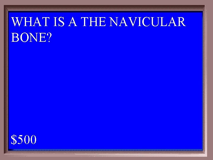WHAT IS A THE NAVICULAR BONE? 1 - 100 1 -500 A $500 