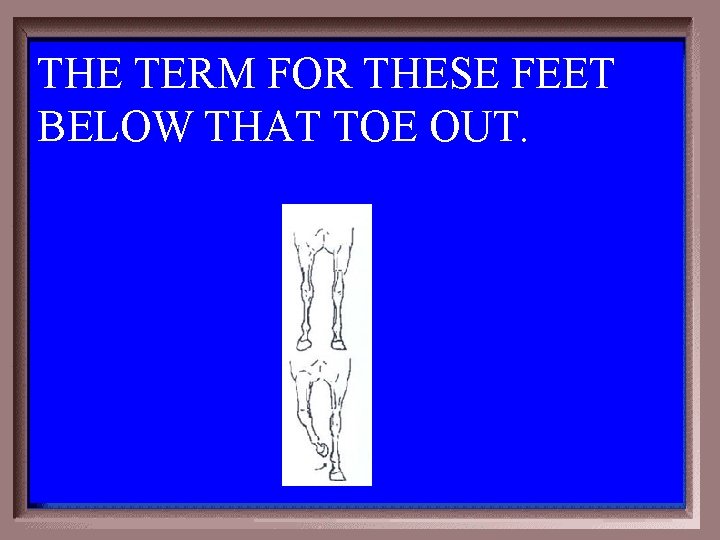 THE TERM FOR THESE FEET BELOW THAT TOE OUT. 1 - 100 3 -100