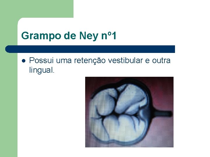 Grampo de Ney nº 1 l Possui uma retenção vestibular e outra lingual. 