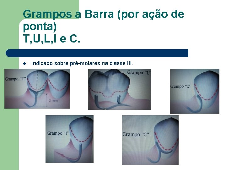 Grampos a Barra (por ação de ponta) T, U, L, I e C. l