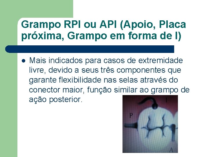 Grampo RPI ou API (Apoio, Placa próxima, Grampo em forma de I) l Mais