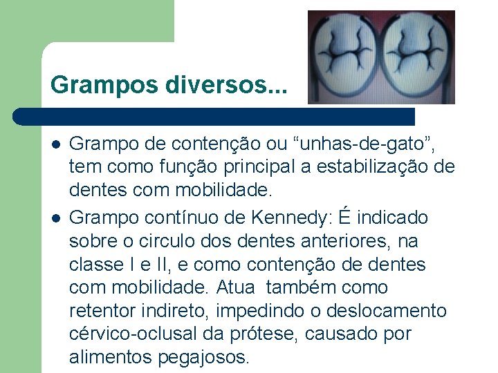 Grampos diversos. . . l l Grampo de contenção ou “unhas-de-gato”, tem como função