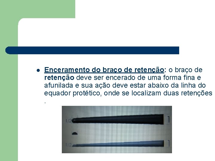 l Enceramento do braço de retenção: o braço de retenção deve ser encerado de