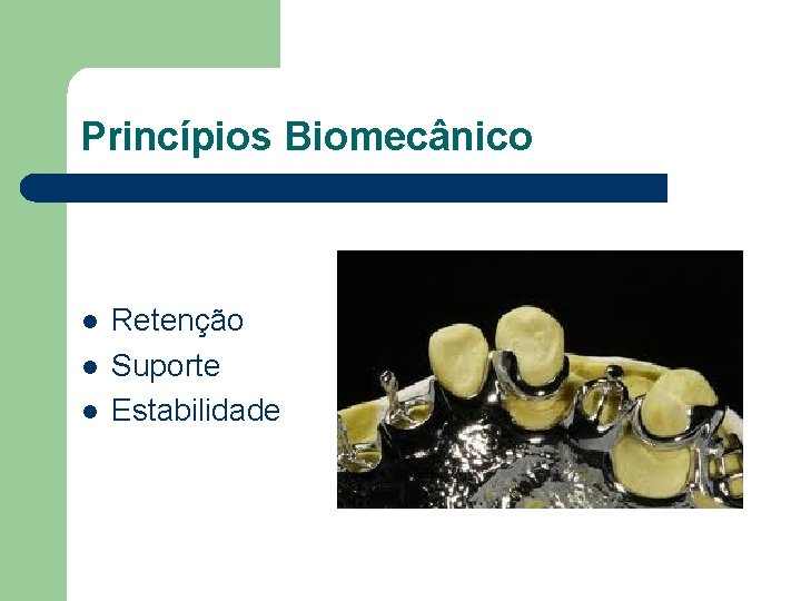 Princípios Biomecânico l l l Retenção Suporte Estabilidade 