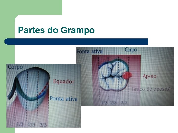 Partes do Grampo 