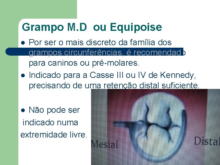 Grampo M. D ou Equipoise l l Por ser o mais discreto da família