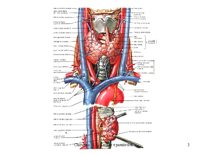Chirurgia - 13 - Tiroide e paratiroidi 3 