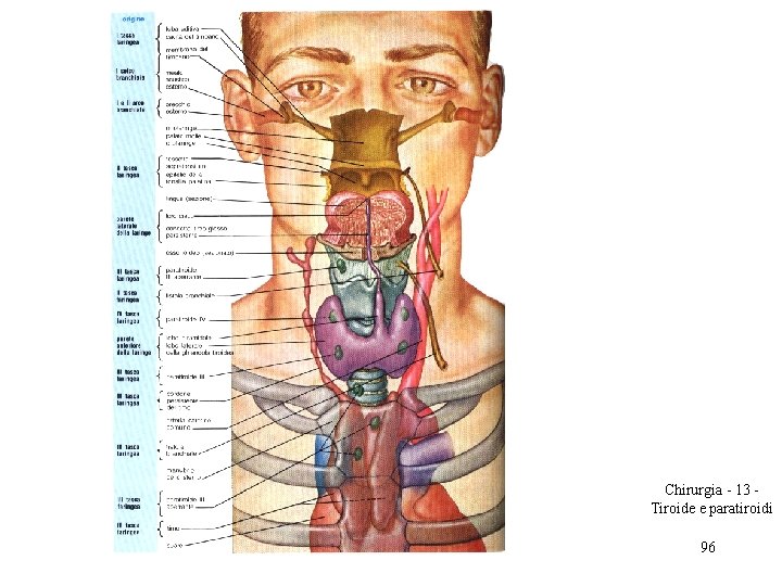Chirurgia - 13 Tiroide e paratiroidi 96 