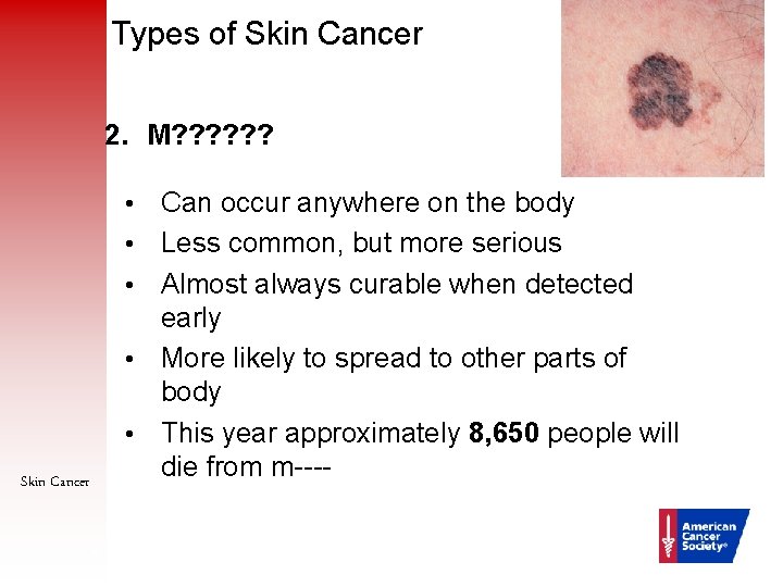 Types of Skin Cancer 2. M? ? ? • • • Skin Cancer 10