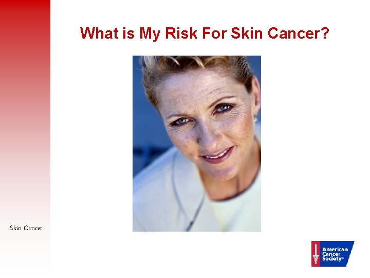 What is My Risk For Skin Cancer? Skin Cancer 17 