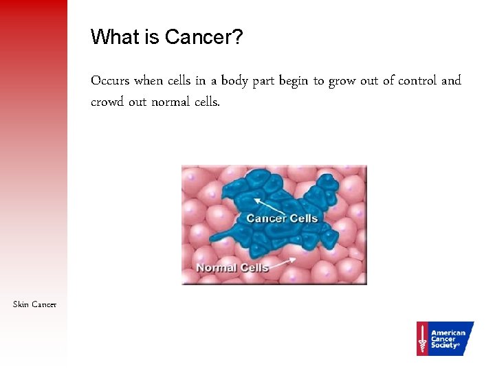 What is Cancer? Occurs when cells in a body part begin to grow out