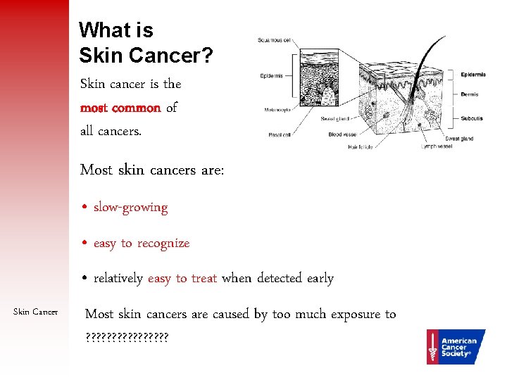 What is Skin Cancer? Skin cancer is the most common of all cancers. Most