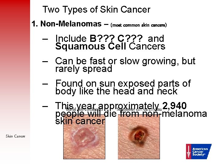 Two Types of Skin Cancer 1. Non-Melanomas – (most common skin cancers) – Include