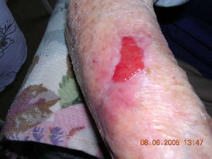 World of Wounds 10 World of Wounds 10