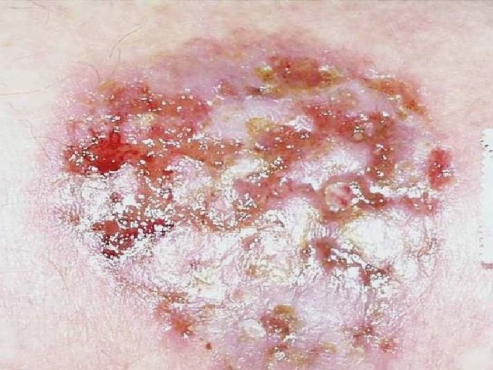 World of Wounds 11 World of Wounds 11