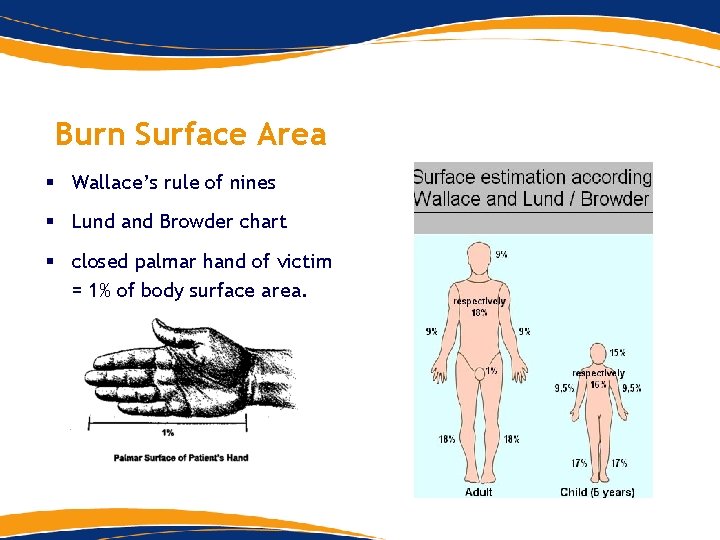 Burn Surface Area § Wallace’s rule of nines § Lund and Browder chart § Burn Surface Area § Wallace’s rule of nines § Lund and Browder chart §