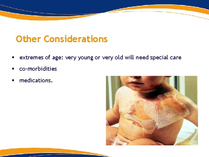 Other Considerations § extremes of age: very young or very old will need special Other Considerations § extremes of age: very young or very old will need special