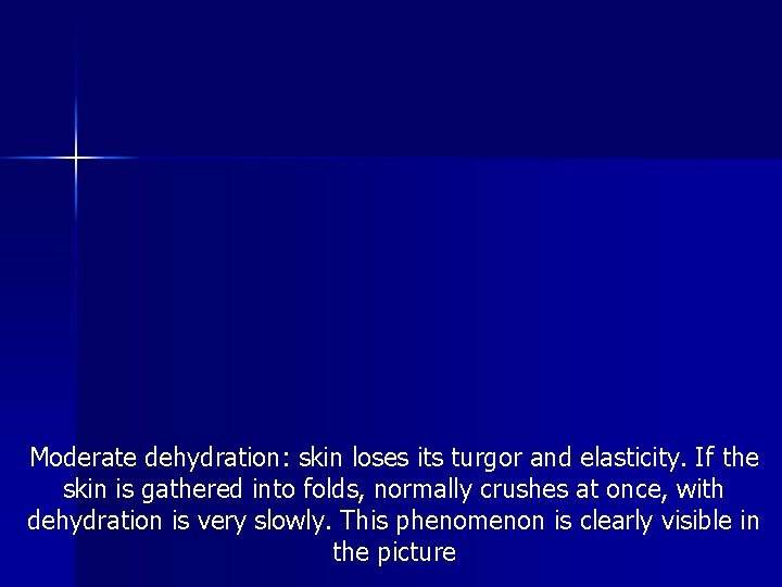 Moderate dehydration: skin loses its turgor and elasticity. If the skin is gathered into