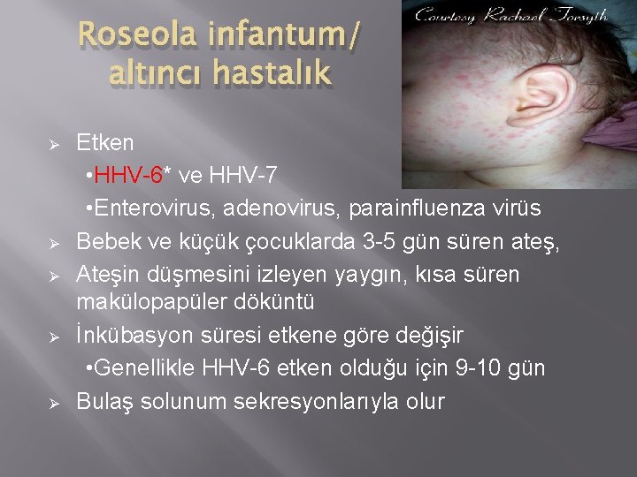 Roseola infantum/ altıncı hastalık Ø Ø Ø Etken • HHV-6* ve HHV-7 • Enterovirus,