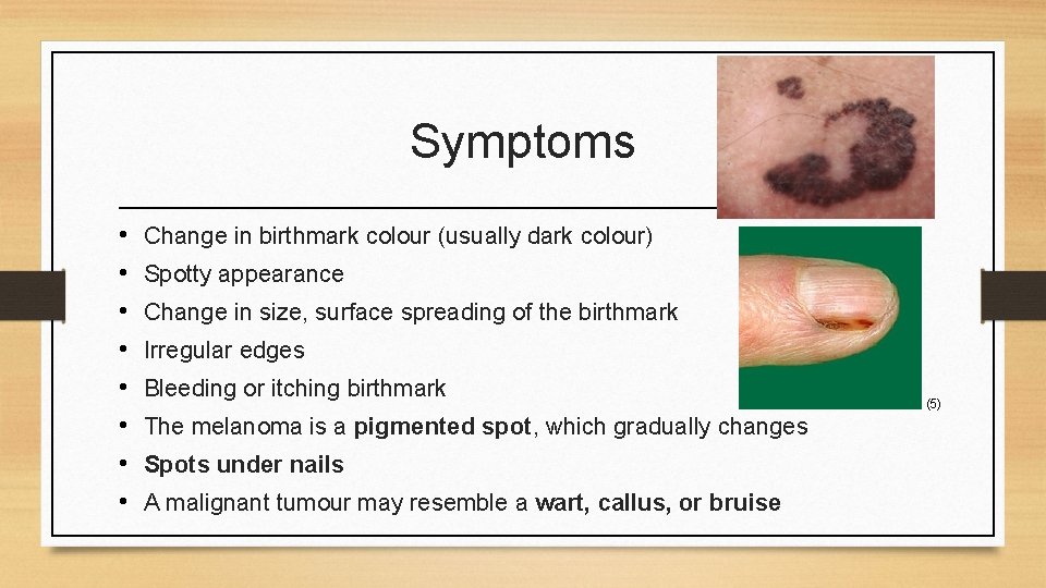 Symptoms • • Change in birthmark colour (usually dark colour) Spotty appearance Change in