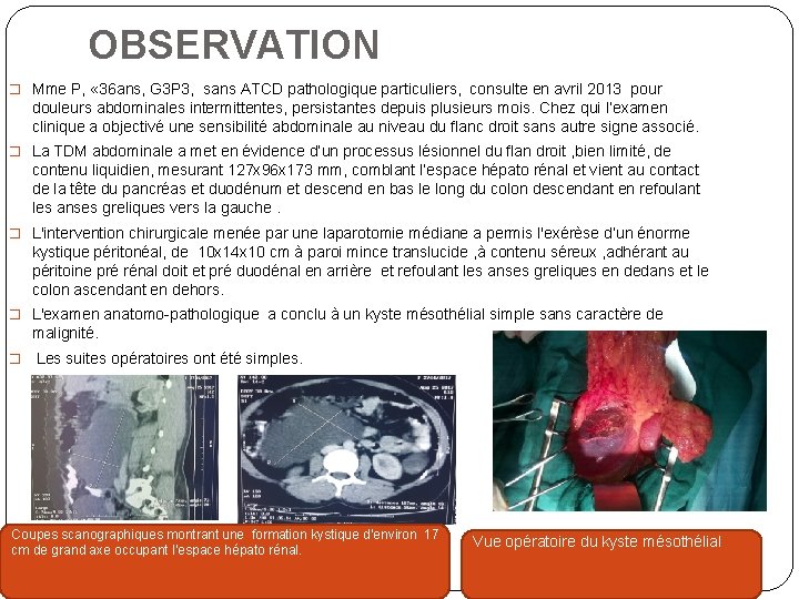 OBSERVATION � Mme P, « 36 ans, G 3 P 3, sans ATCD pathologique