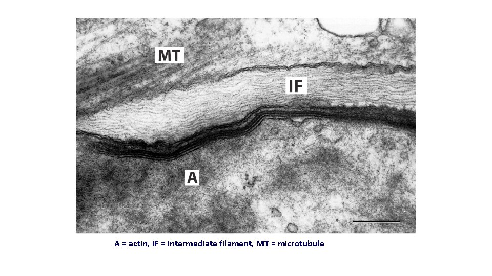A = actin, IF = intermediate filament, MT = microtubule A = actin, IF = intermediate filament, MT = microtubule