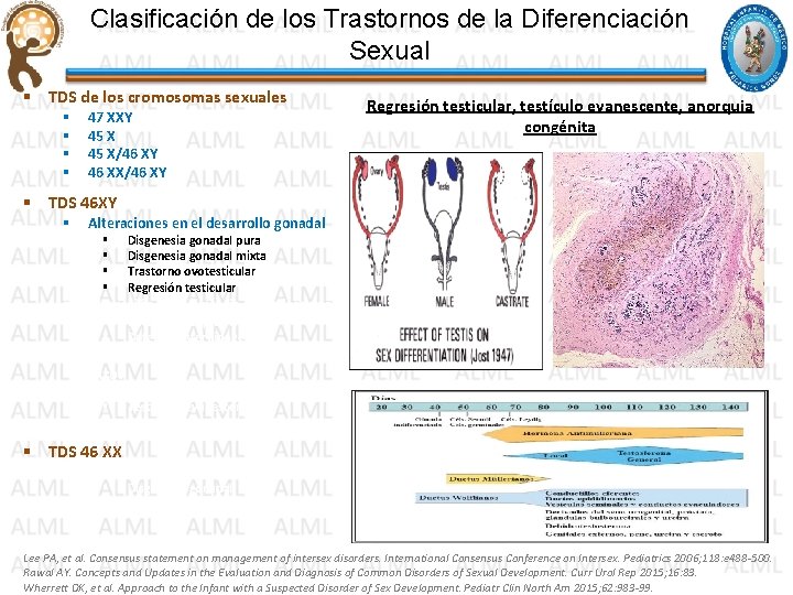 Clasificación de los Trastornos de la Diferenciación Sexual § TDS de los cromosomas sexuales Clasificación de los Trastornos de la Diferenciación Sexual § TDS de los cromosomas sexuales