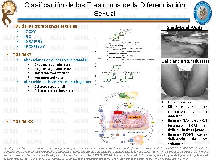 Clasificación de los Trastornos de la Diferenciación Sexual § TDS de los cromosomas sexuales Clasificación de los Trastornos de la Diferenciación Sexual § TDS de los cromosomas sexuales