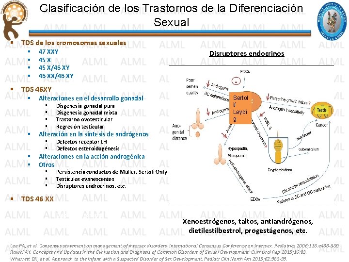 Clasificación de los Trastornos de la Diferenciación Sexual § TDS de los cromosomas sexuales Clasificación de los Trastornos de la Diferenciación Sexual § TDS de los cromosomas sexuales